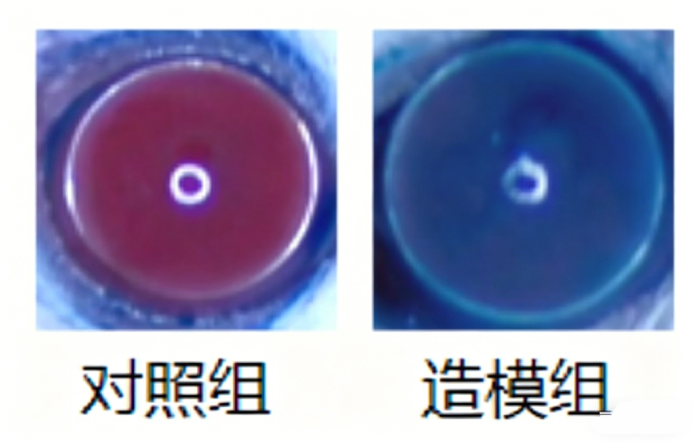 11.png